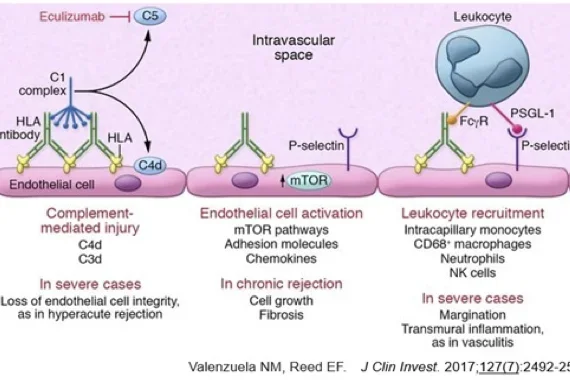 Schematic explaining DSA-activated endothelium and macrophage polarization.